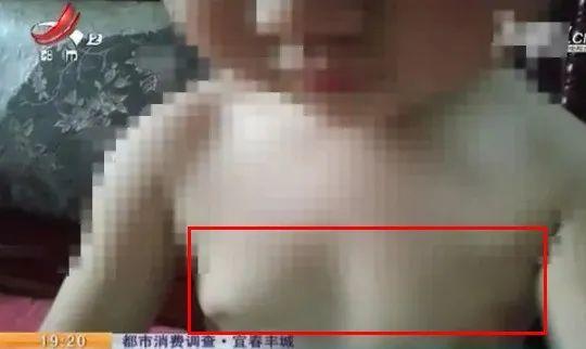 1岁半女婴疑因奶粉胸部发育！乳房鼓起是性早熟吗？