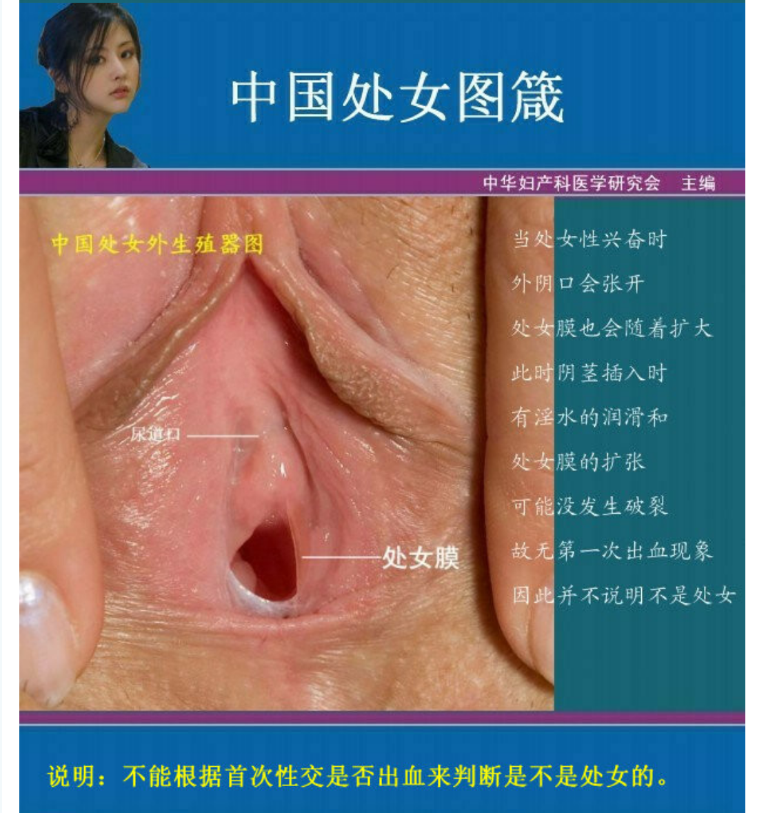 女人处女膜高清图片鉴定及破处后照片区别 男人必备