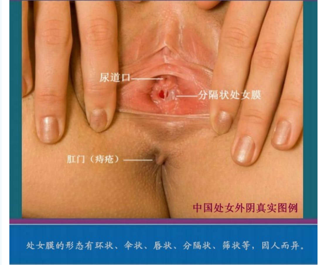 女人处女膜高清图片鉴定及破处后照片区别 男人必备